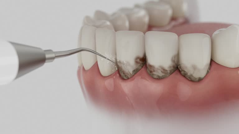 Trusted Invisalign Clear Aligners service in San Luis Obispo, CA - Dentist Open Now